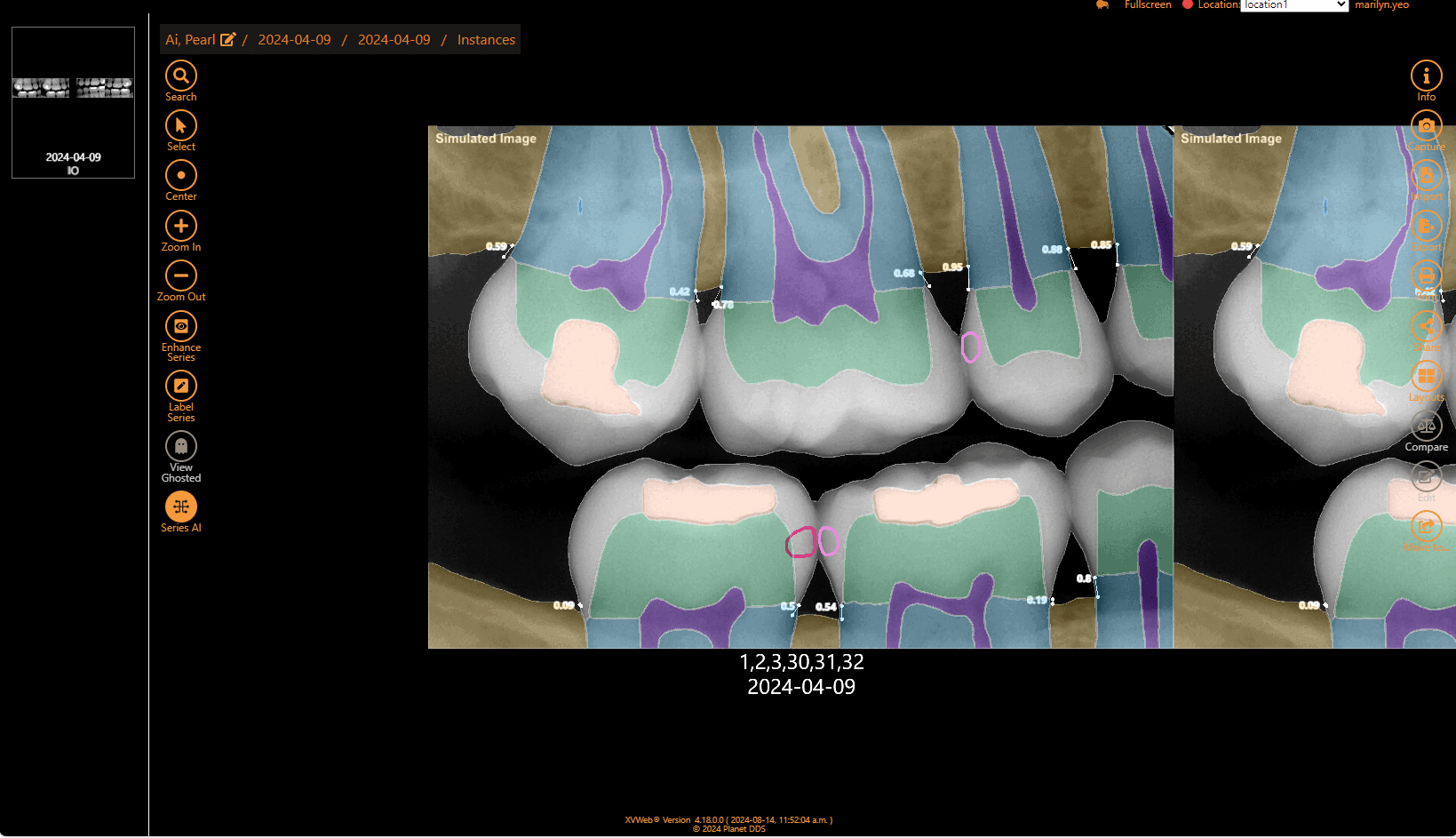 The most advanced dental imaging AI analysis