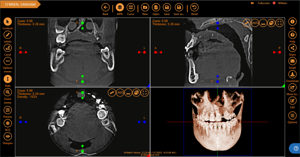 Cloud-based Apteryx dental imaging offers offsite backups and disaster recovery